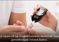 Чихрийн шижингийн эрсдэлээ үнэлээрэй