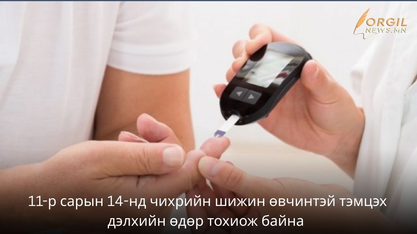 Чихрийн шижингийн эрсдэлээ үнэлээрэй