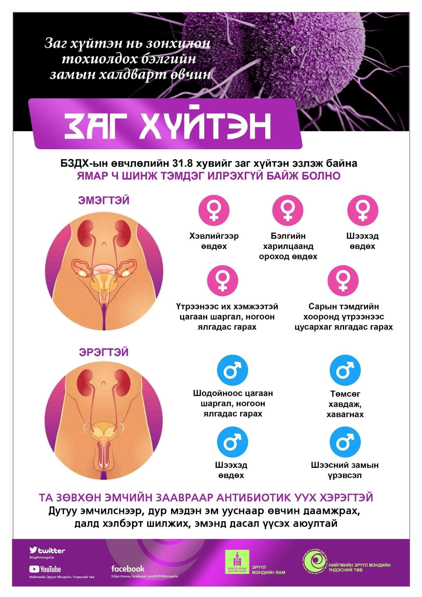15-39 насны залуучууд дунд бэлгийн замын халдвар өндөр хувьтай байна