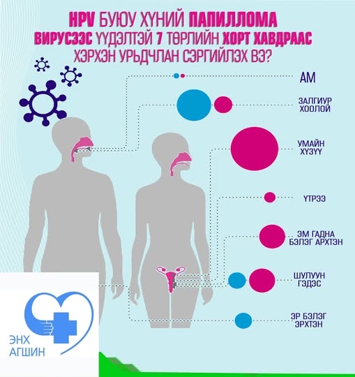 Хүний папиллома вирусээс хамгаалах вакциныг 11 настай хүүхдүүдэд товлолын дагуу хийж байна.