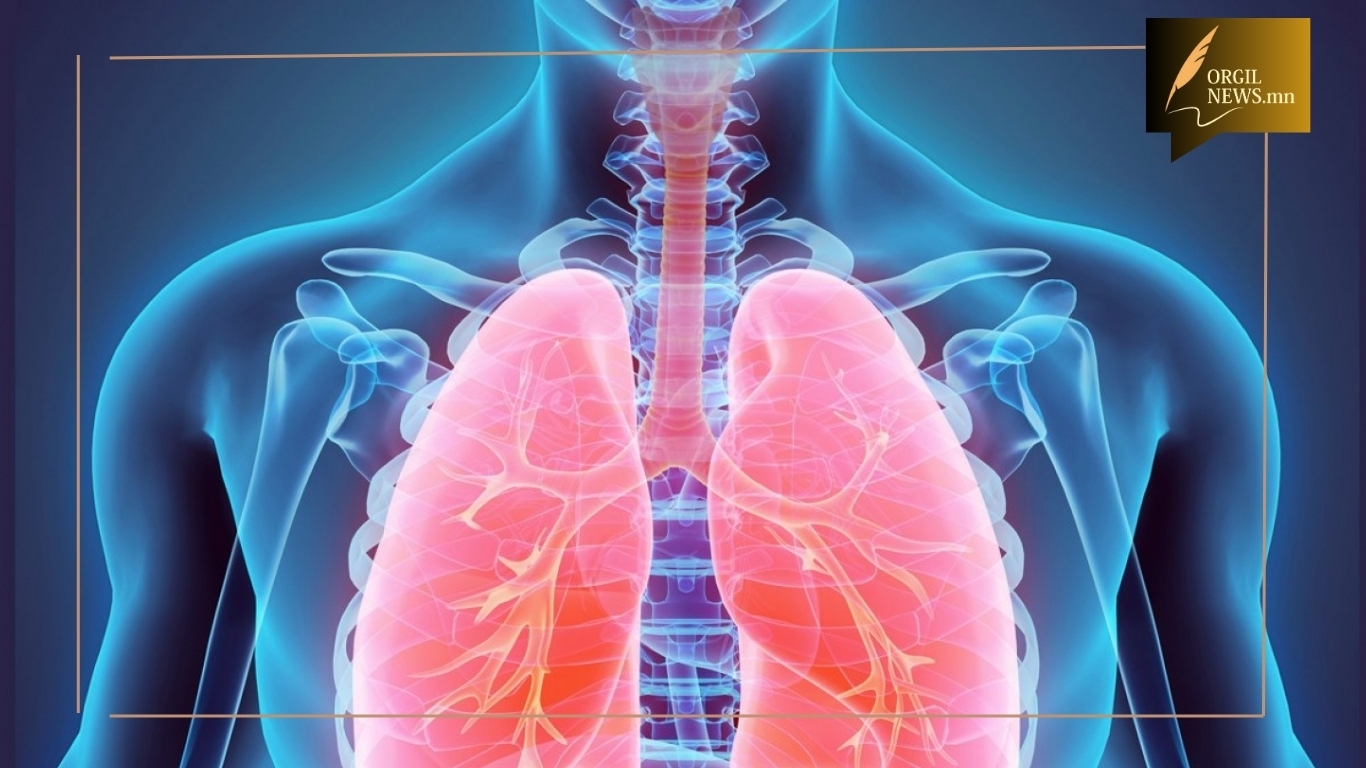 Ойролцоогоор жил бүр уушгины хорт хавдрын  700 шинэ тохиолдол бүртгэгдэж байна.